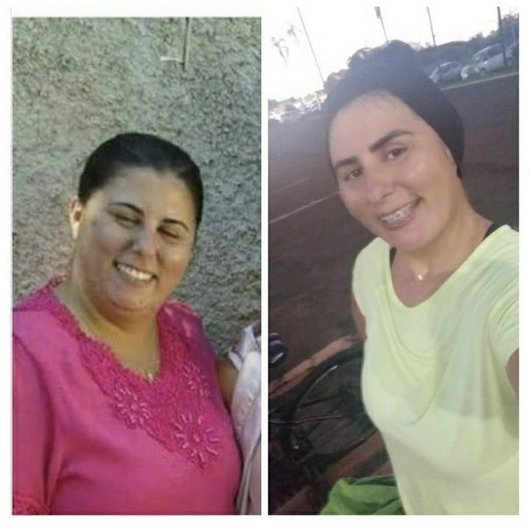 Antes e depois de aluna do Emagreça Correndo